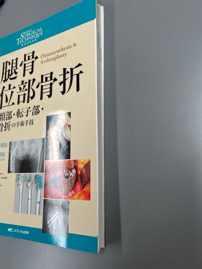 大腿骨近位部骨折 Surgical technique 裁断済み